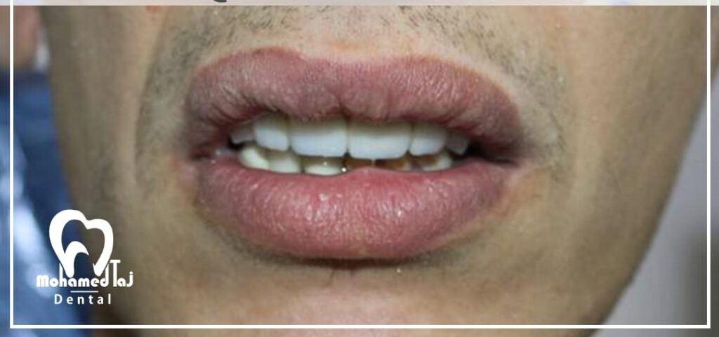 After treatment image