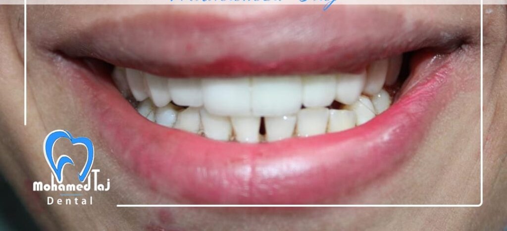 After treatment image